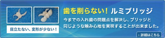 歯を削らないルミブリッジ